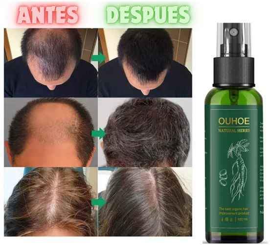 TONICO  CAPILAR