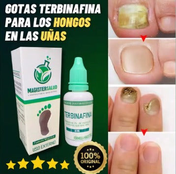 GOTAS DE TERBINAFINA PARA LOS HONGOS EN LAS UÑAS